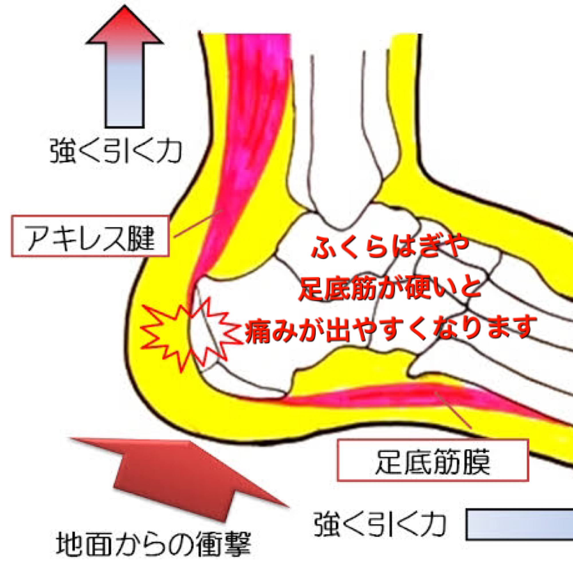 シーバー