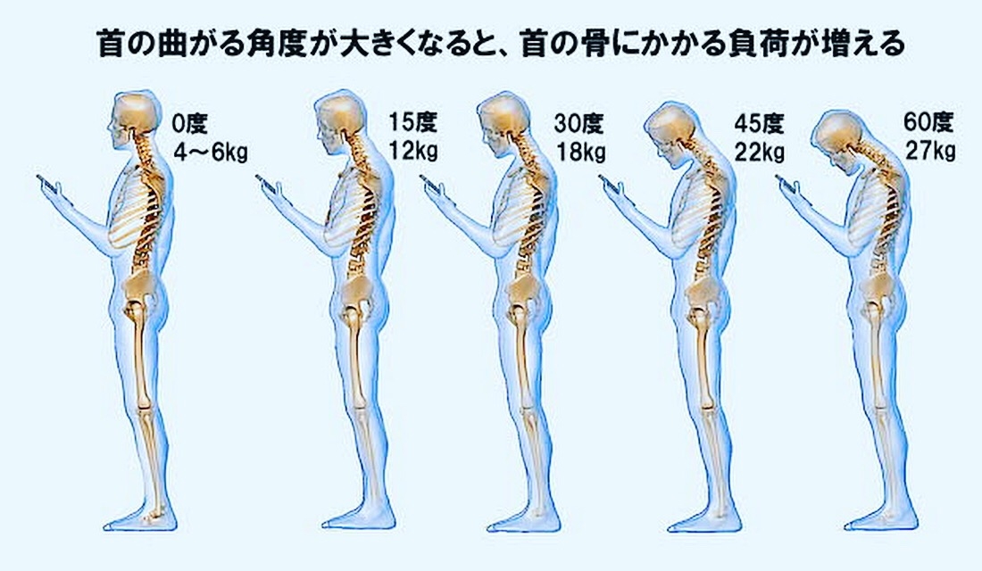 姿勢の悪さと首肩にかかる負荷 姿勢の悪さと首肩にかかる負荷